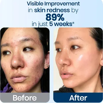 AGELESS RENEWAL+ ADVANCED ANTI-AGING CELL COMPLEX