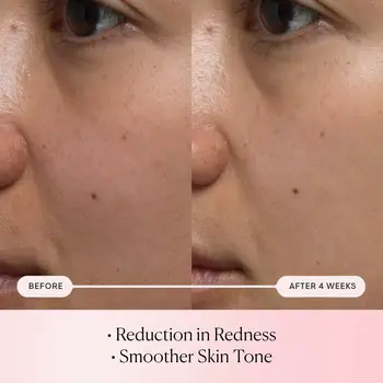 Facial Serum Elemis