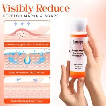 Stretch mark remover oil
