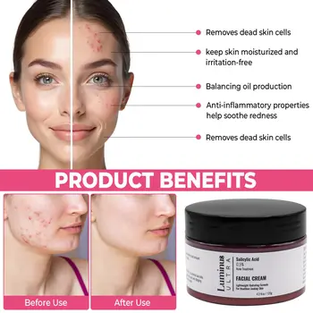0.5% Salicylic Acne Cream