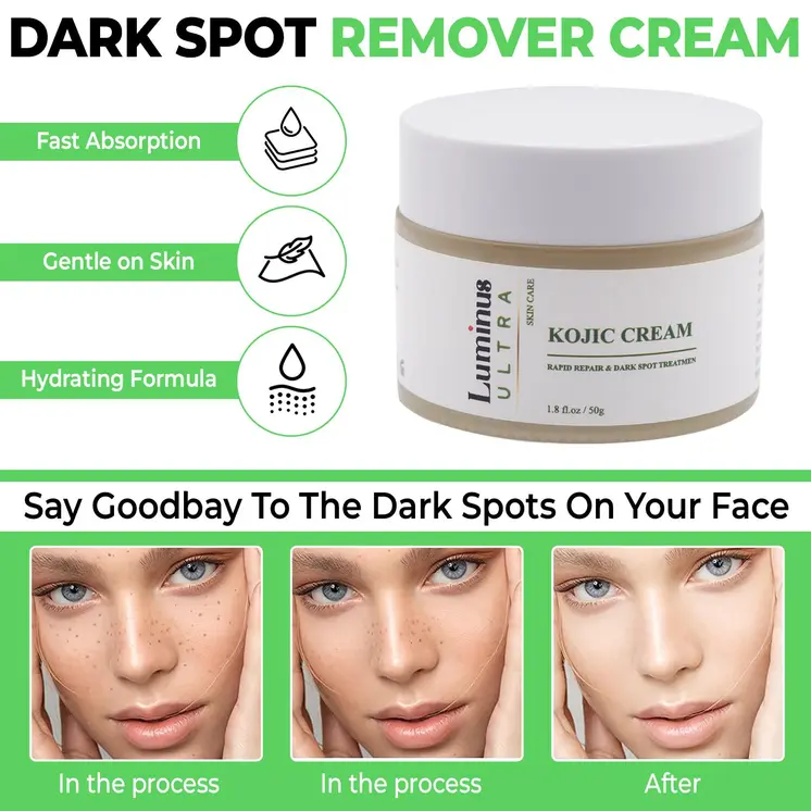 Kojic Acid Blackhead Cream