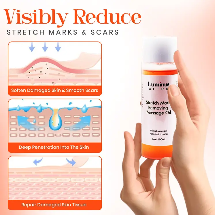 Stretch mark remover oil